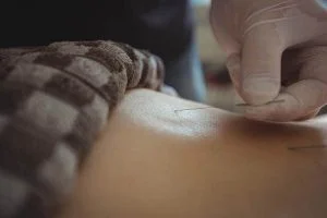 Acupuncture-A-Drug-free-Solution-to-Your-Aches-and-Pains