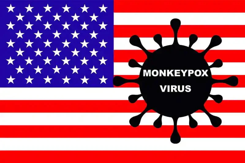 monkeypox-usa