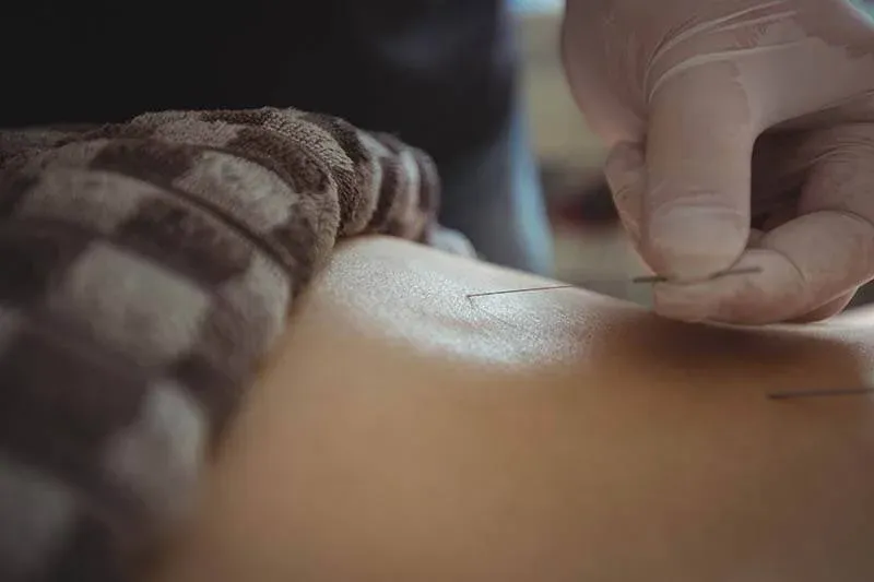 Acupuncture-A-Drug-free-Solution-to-Your-Aches-and-Pains