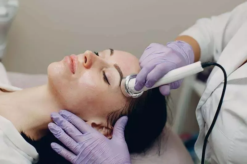 microneedling