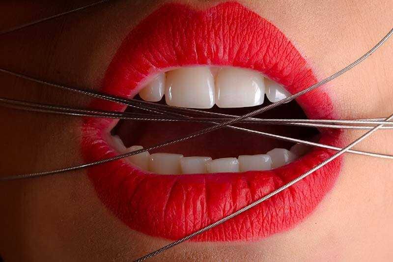 The-Pros-and-Cons-of-Teeth-Whitening