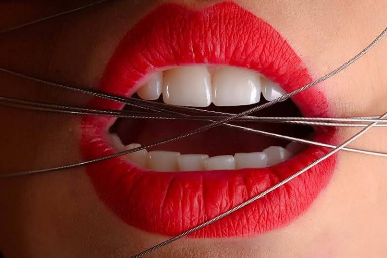 The-Pros-and-Cons-of-Teeth-Whitening
