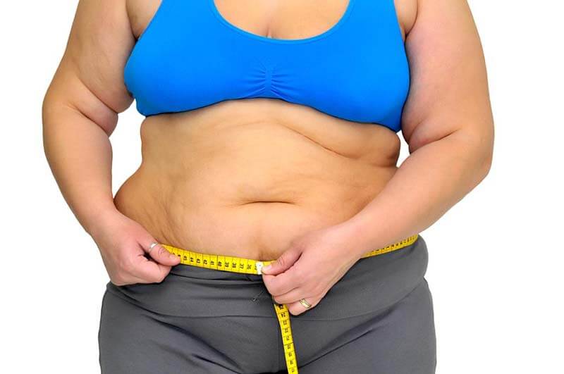 obesity