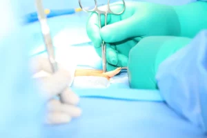 Hernia-Pain-Why-Early-Detection-is-Key-to-Reclaiming Your Life