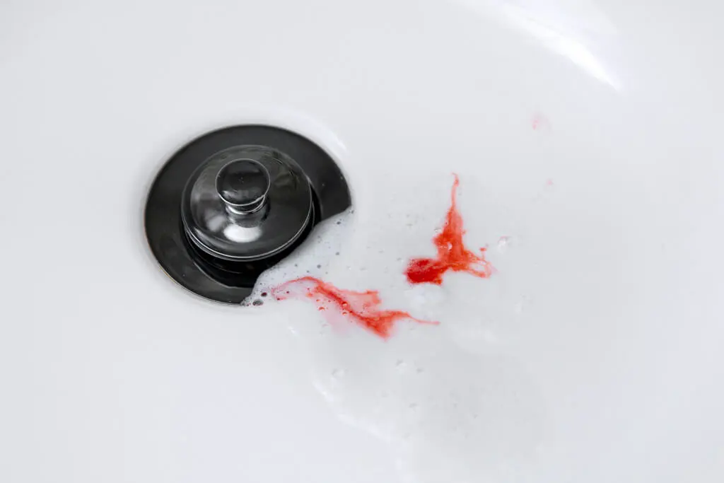 bleeding-gums