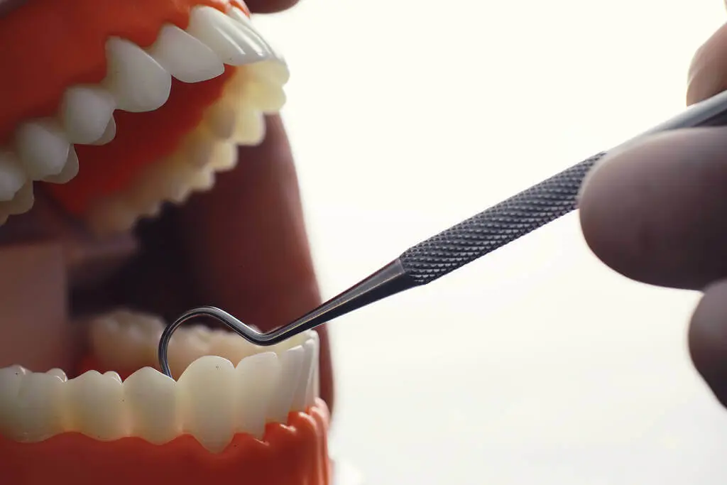 mouth-examination