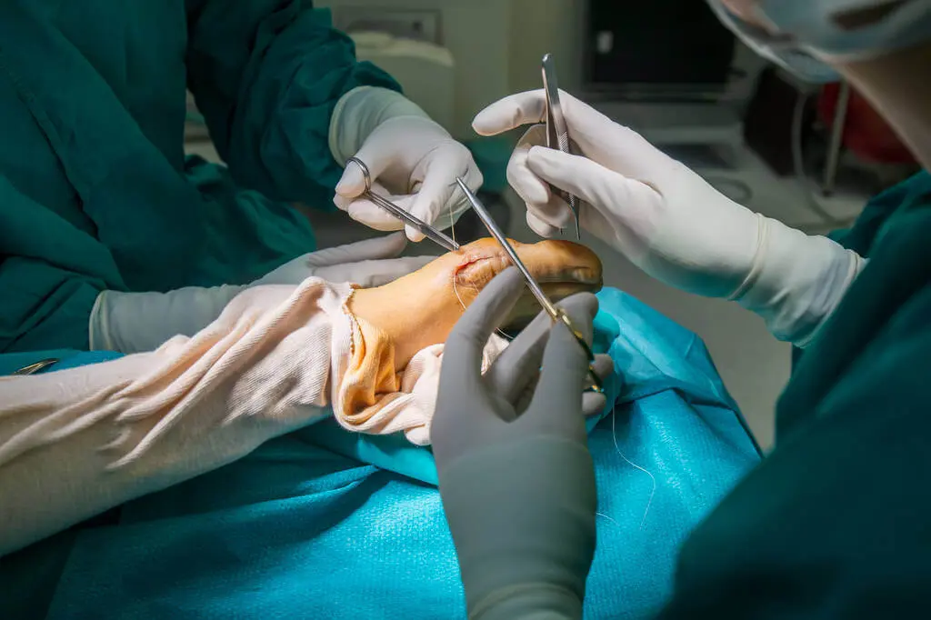 foot-surgery